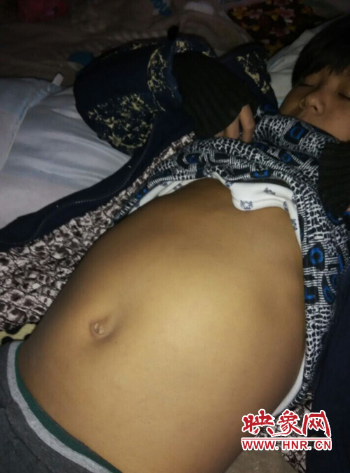 寧陵少年患病十幾年仍堅(jiān)持上學(xué) 無(wú)錢(qián)治病盼救助