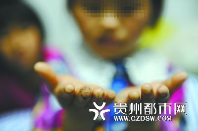 指尖被針扎得傷痕累累。