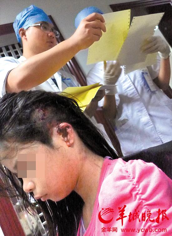 受傷的11歲女孩頭發(fā)被卷入扶梯，耳朵被嚴(yán)重拉傷，需手術(shù)。
