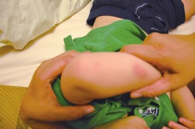 孩子身上有多處明顯傷痕。京華時(shí)報(bào)讀者供圖