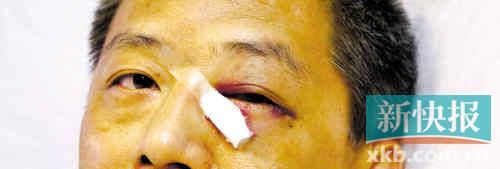 ■這起醫(yī)鬧事件，受傷的遠遠不只是熊旭明醫(yī)生的身體。