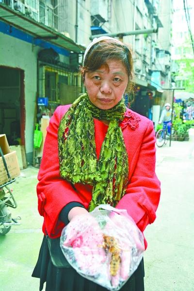 頭部受傷的黃女士展示兩根大魚刺。