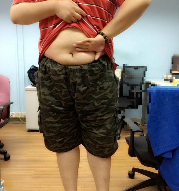 反手摸肚臍“炫腹”模式走紅 專家稱與胖瘦無(wú)關(guān)