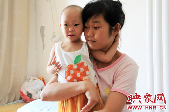 孩子和媽媽在一起，她的右眼已經(jīng)失明。