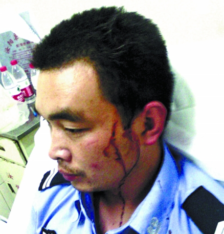 汝陽協(xié)警遭賭徒暴力抗法并圍毆 公安局稱這是內(nèi)部的事 汝陽協(xié)警遭賭徒暴力抗法并圍毆 公安局稱這是內(nèi)部的事