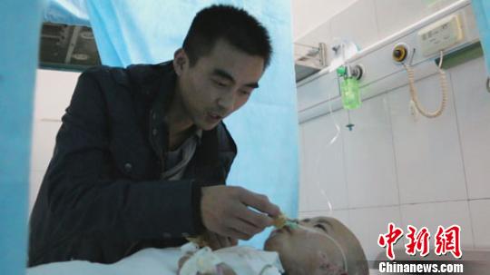 河南掉油鍋重傷女童4次植皮已轉(zhuǎn)出重癥監(jiān)護(hù)室 河南掉油鍋重傷女童4次植皮已轉(zhuǎn)出重癥監(jiān)護(hù)室