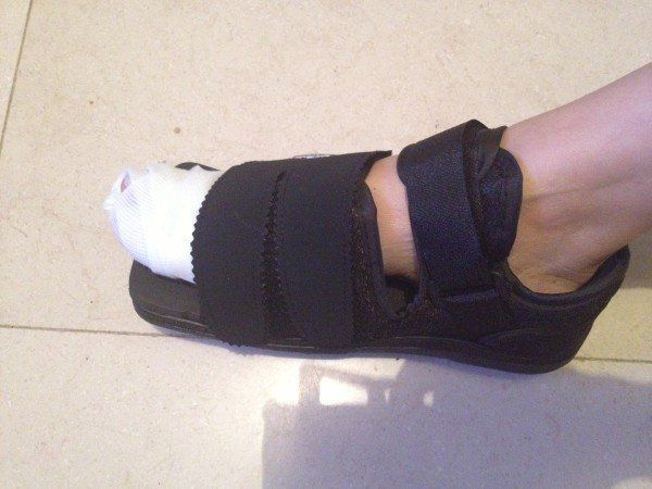 香港女星雨僑誤踢硬物腳趾骨裂錯(cuò)失角色損失大 香港女星雨僑誤踢硬物腳趾骨裂錯(cuò)失角色損失大