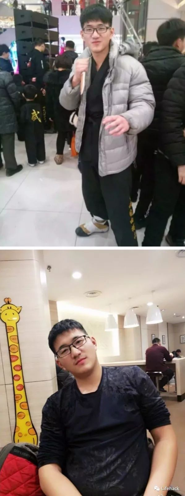 長胖20斤，臉型怎么變？這些例子看完扎心了！