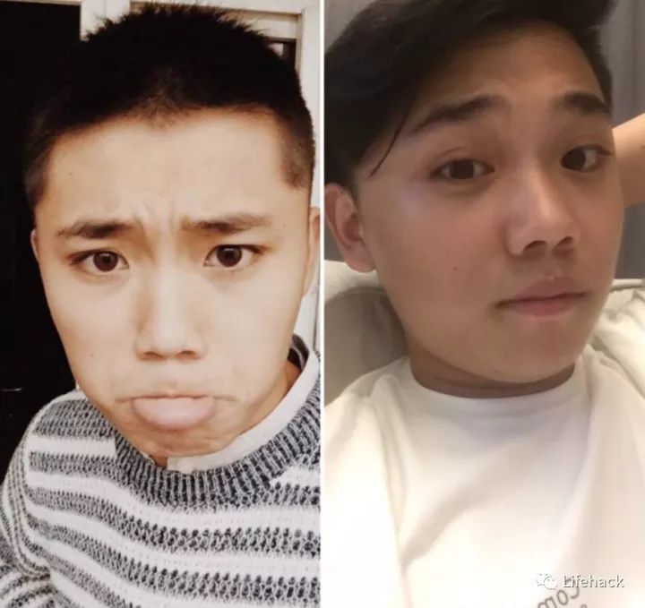 長胖20斤，臉型怎么變？這些例子看完扎心了！