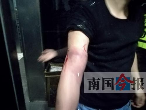 覃先生手臂被卡的部位受傷流血，所幸傷勢(shì)無(wú)大礙。 通訊員 王建民 攝