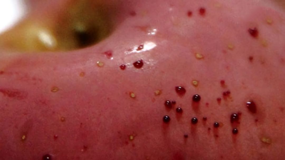 嚇懵！女子用熱水泡蘋果結(jié)果冒出血珠 咋回事？