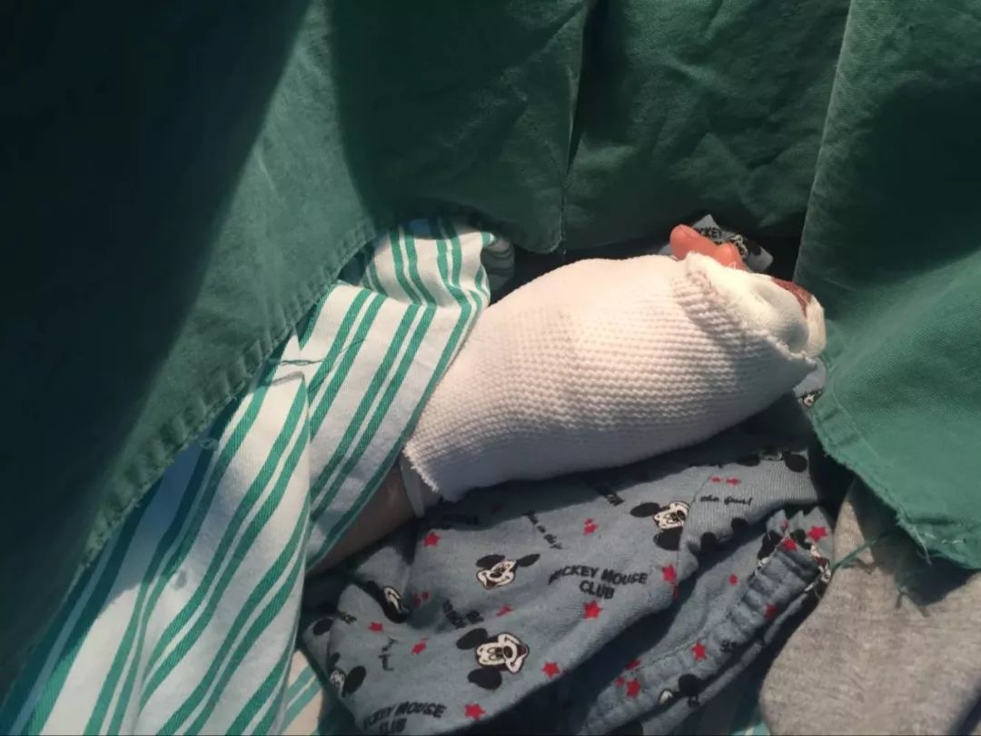 嚇哭！6歲男孩被夾斷手指 罪魁禍首竟是校服