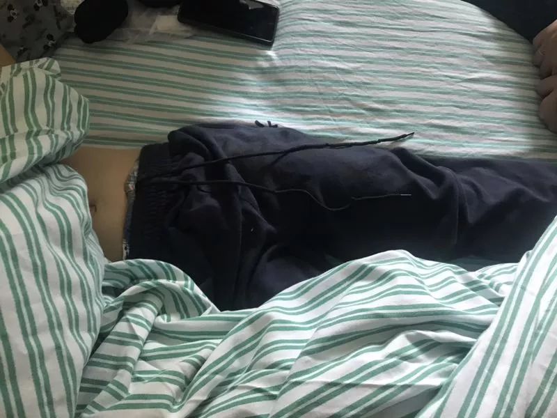 嚇哭！6歲男孩被夾斷手指 罪魁禍首竟是校服