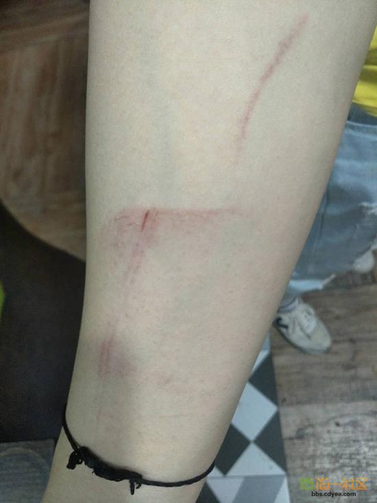 女網(wǎng)友舉報網(wǎng)帖中出示的被打后照片。