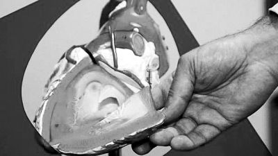 威廉斯領導的研究團隊已經(jīng)利用人體脂肪干細胞，成功3D打印出心臟血管和心臟瓣膜，待一顆心臟的所有部件打