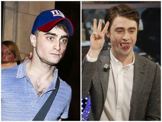 丹尼爾日前被拍到骨瘦如柴，不似2月份健康