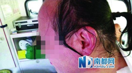 涉事教師遭熱水潑臉后的照片。