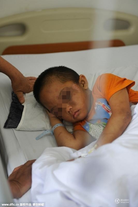 圖為全身傷痕累累的小進(jìn)。