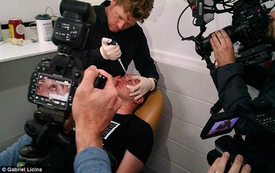 該實(shí)驗(yàn)是由加州一支名為“生物駭客”的實(shí)驗(yàn)團(tuán)隊(duì)開展的。他們使用了一種名為二氫卟吩e6（Ce6）的物質(zhì)的溶液。Ce6常見于深海魚體內(nèi)，有光敏特性，通常用于癌癥治療研究中。研究團(tuán)隊(duì)將Ce6與胰島素和鹽水混合起來，得到一種溶液，可以在低光照條件下提高人類的視力。